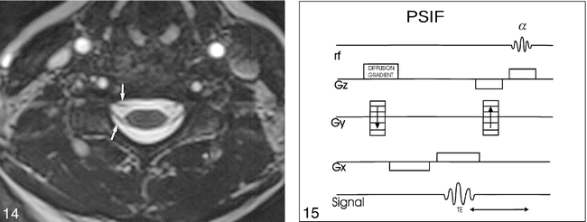 fig 14.