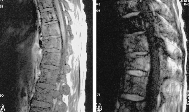 fig 16.