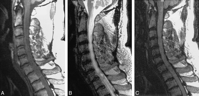 fig 6.
