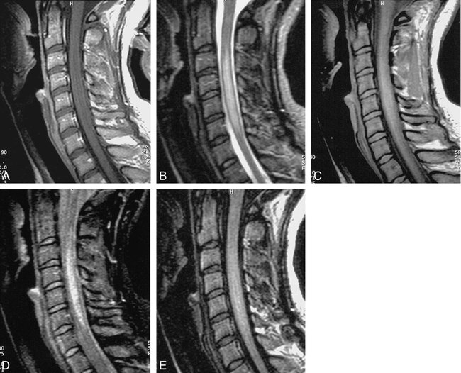 fig 8.