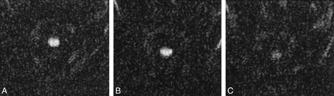 fig 10.