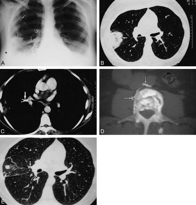 fig 1.