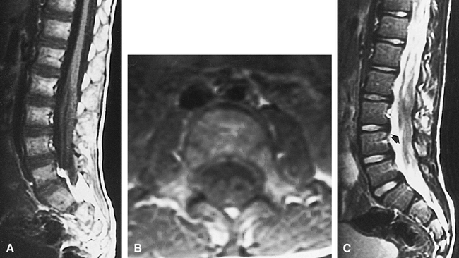 fig 1.