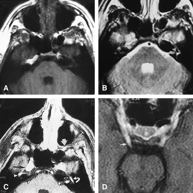 fig 2.