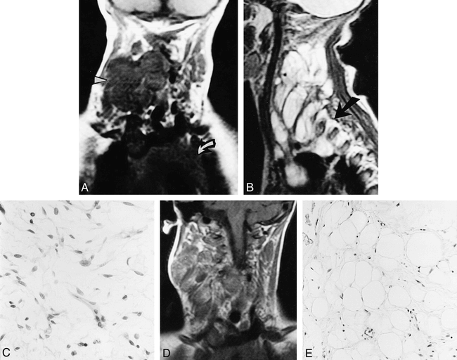 fig 1.