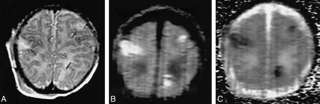 fig 3.