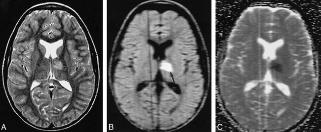 fig 4.