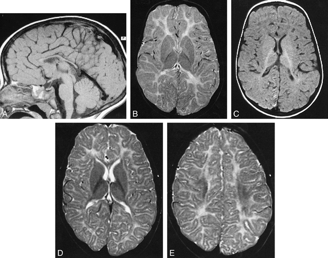 fig 1.