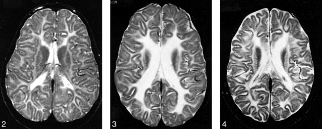 fig 2.