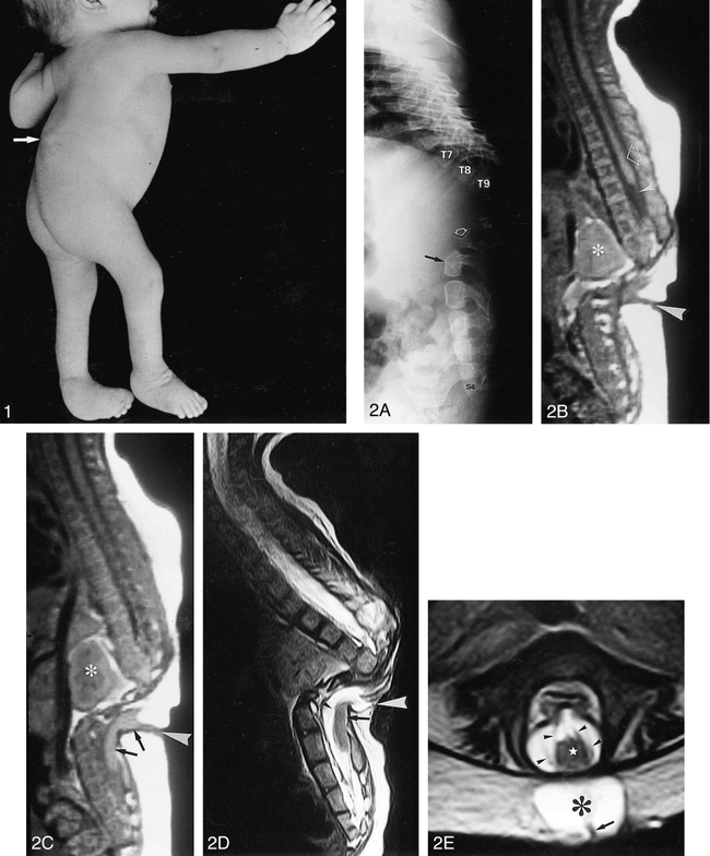 fig 1.