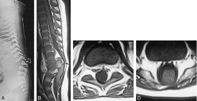 fig 3.