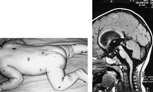 fig 1.