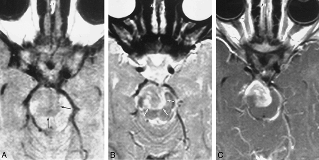 fig 3.