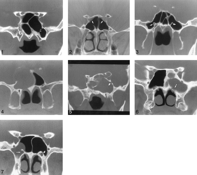 fig 1.