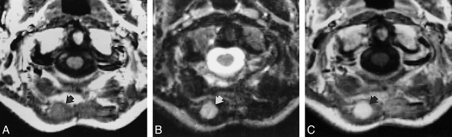 fig 1.