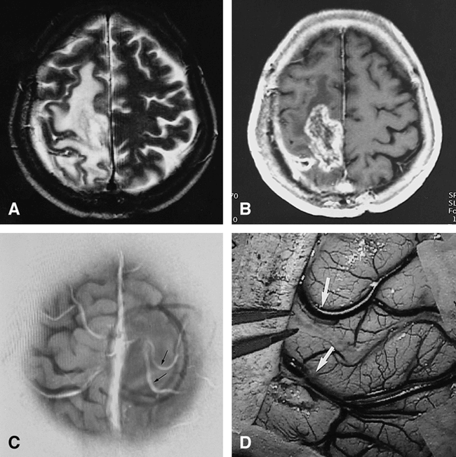 fig 2.