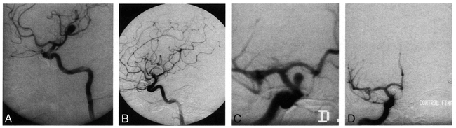 fig 1.