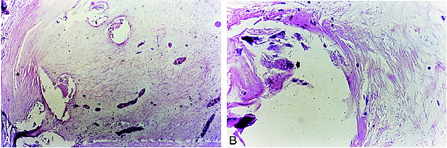 fig 3.