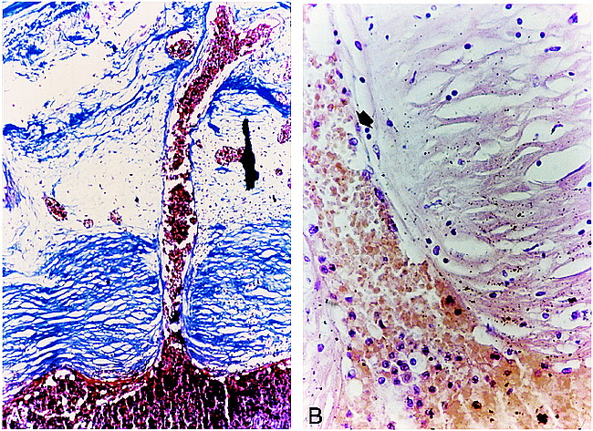 fig 4.