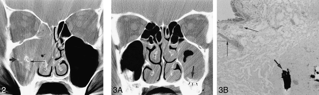 fig 2.