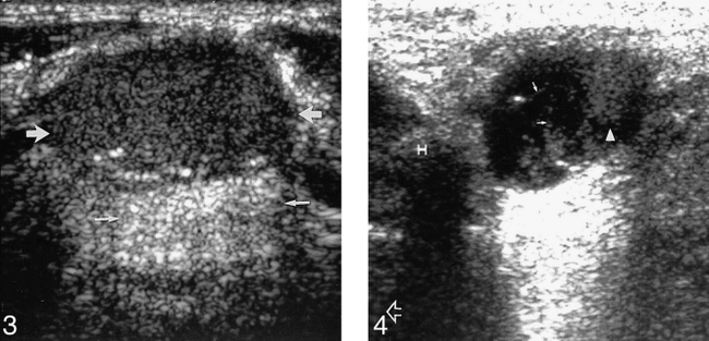 fig 3.