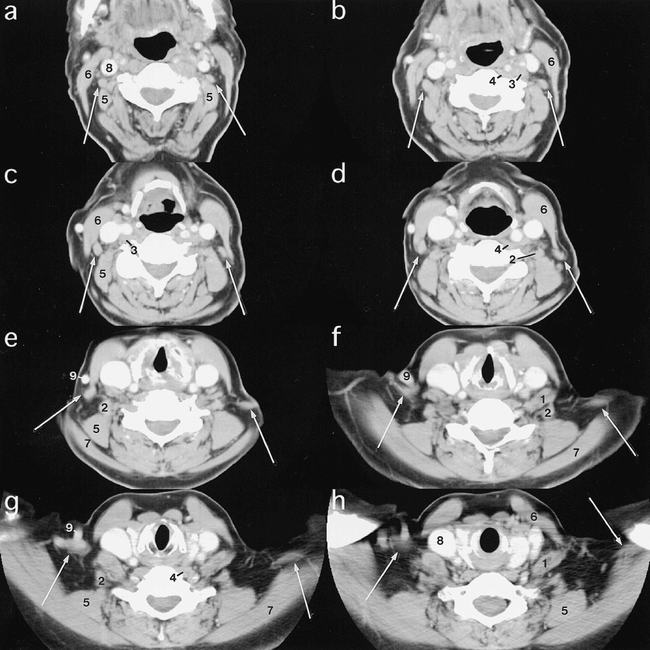 fig 2.