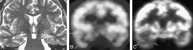 fig 2.