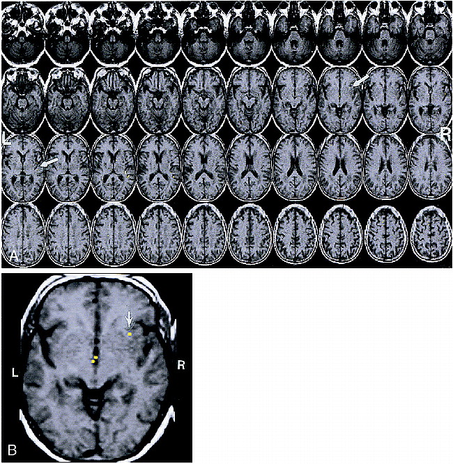 fig 1.
