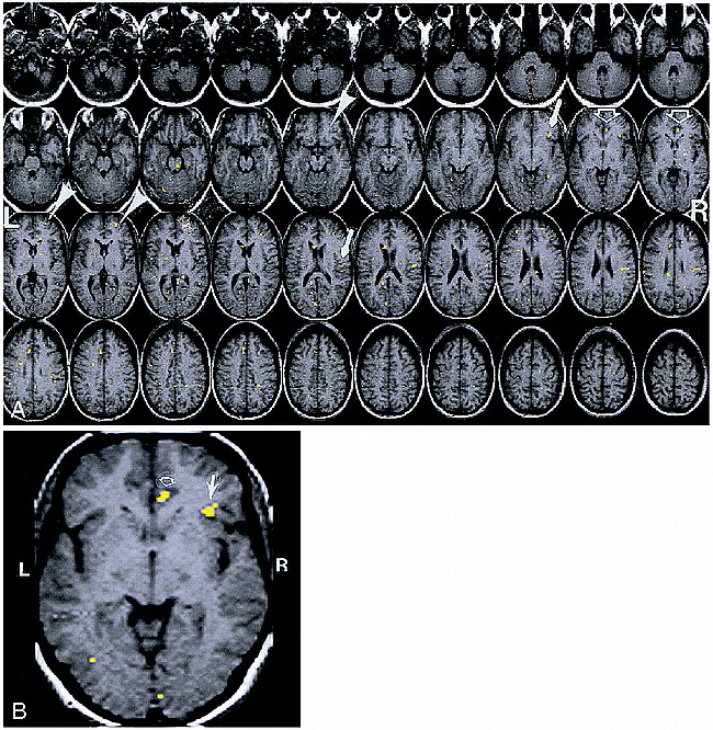 fig 3.