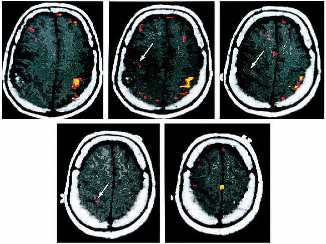 fig 1.