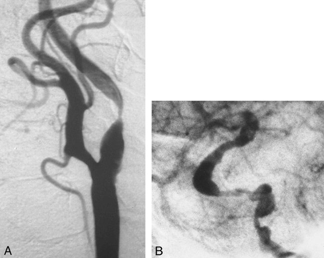 fig 1.