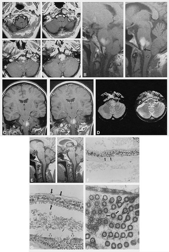 fig 1.