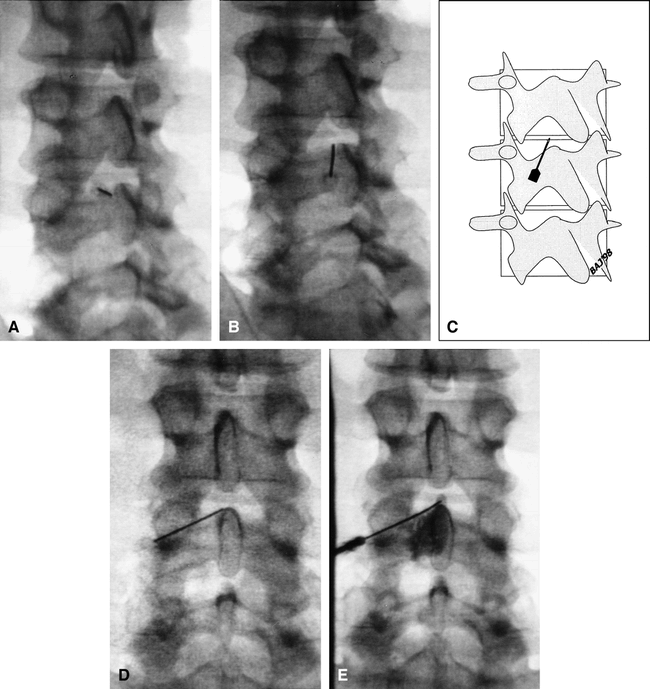 fig 1.