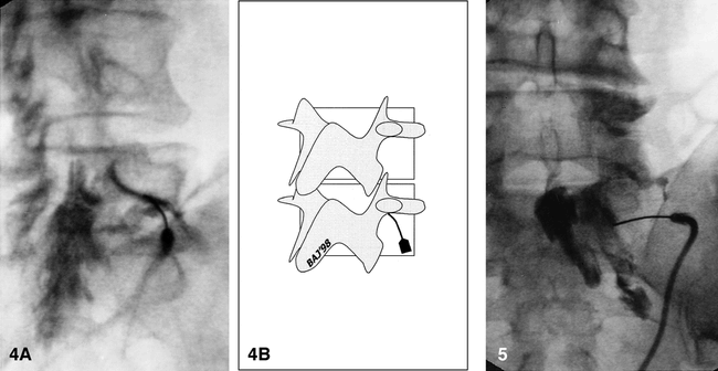 fig 4.
