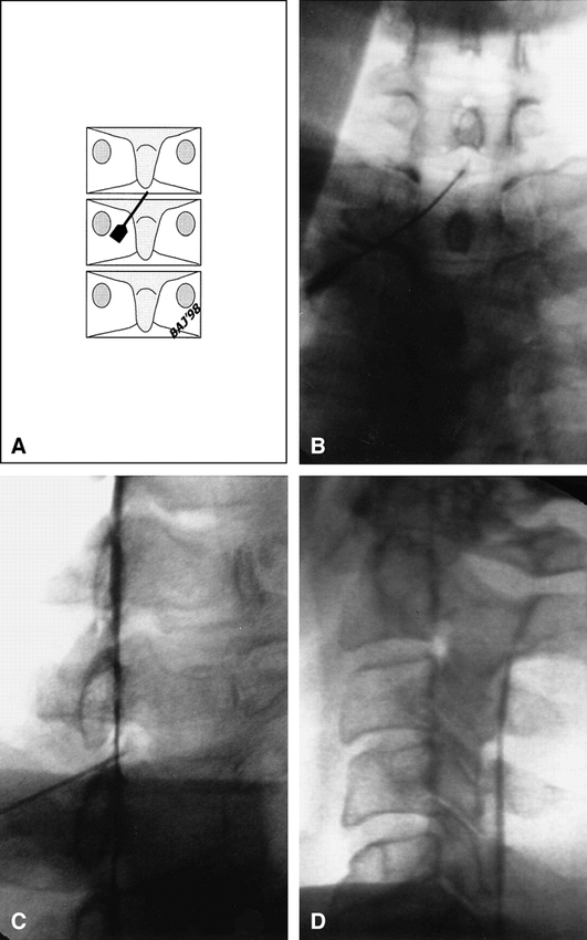 fig 7.