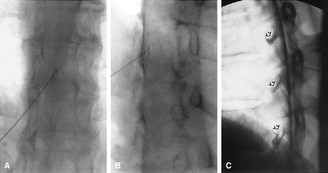 fig 8.
