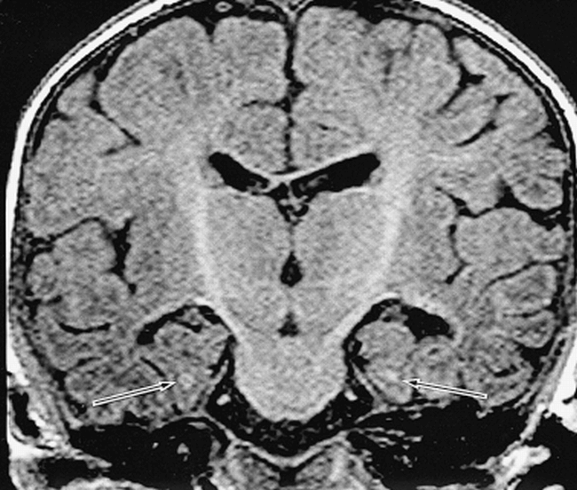 fig 6.