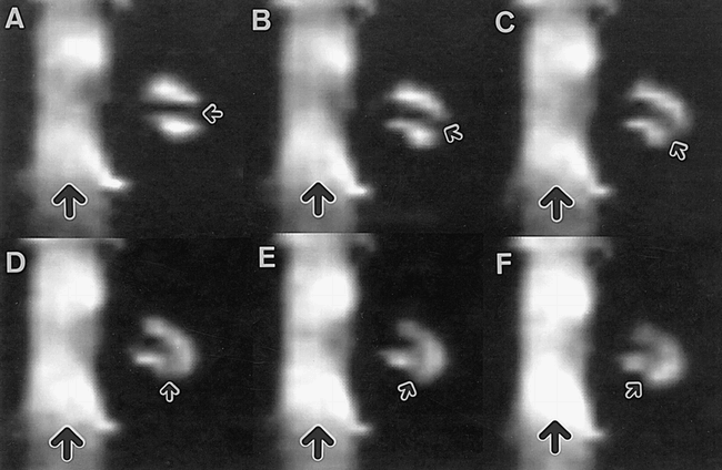 fig 3.