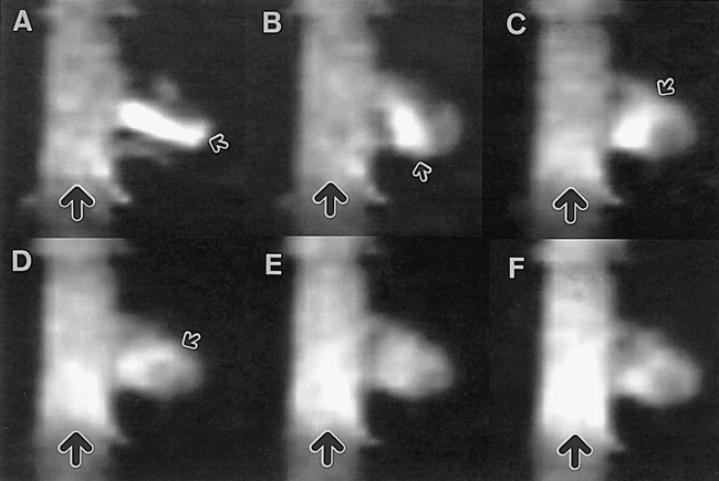 fig 4.