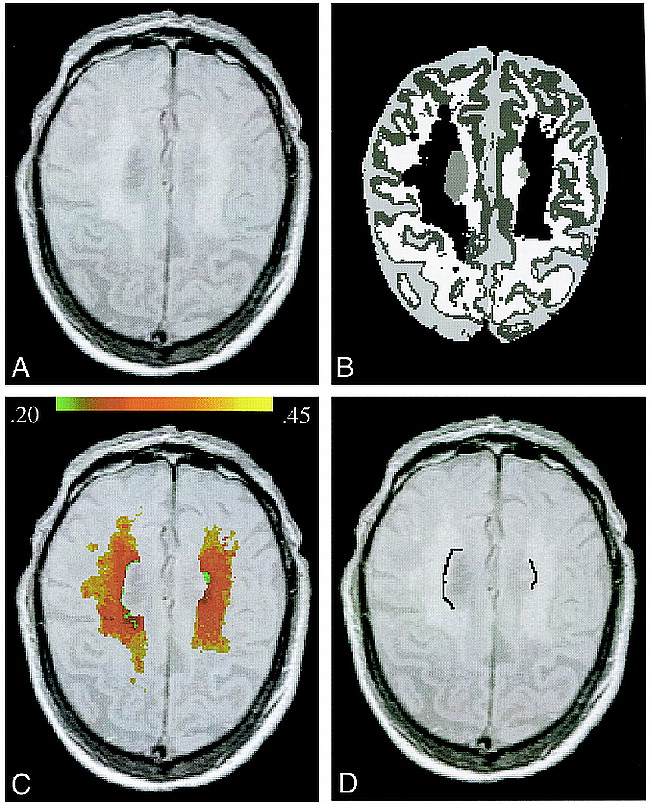 fig 1.