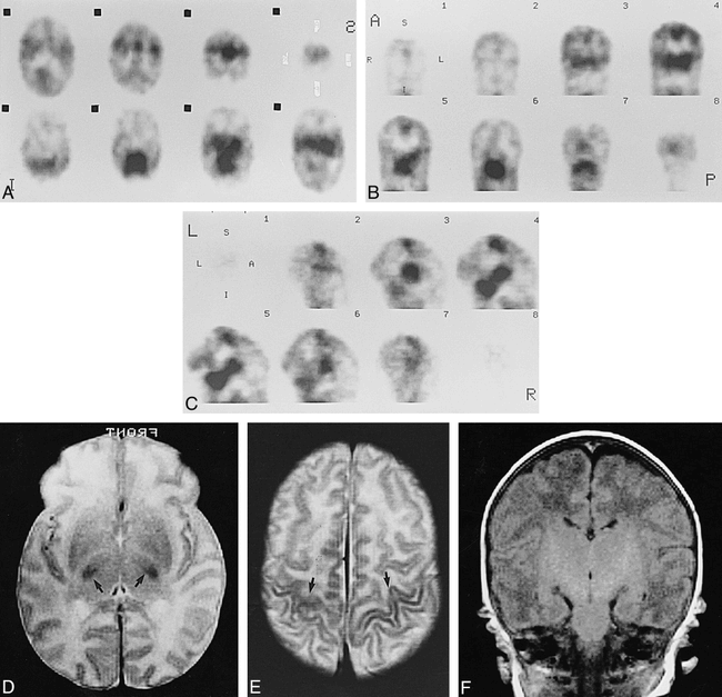 fig 2.