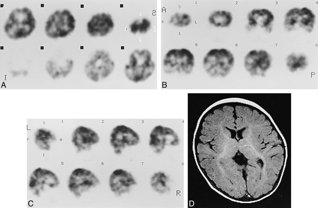 fig 5.
