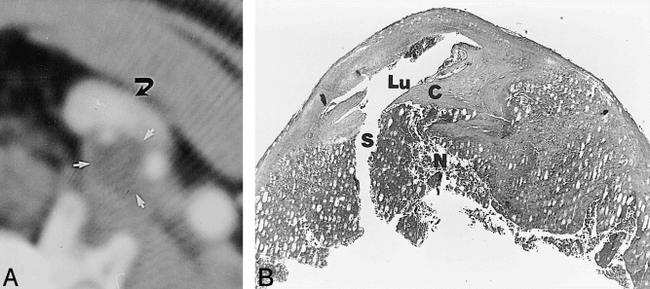 fig 2.
