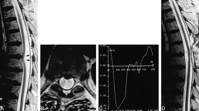 fig 2.