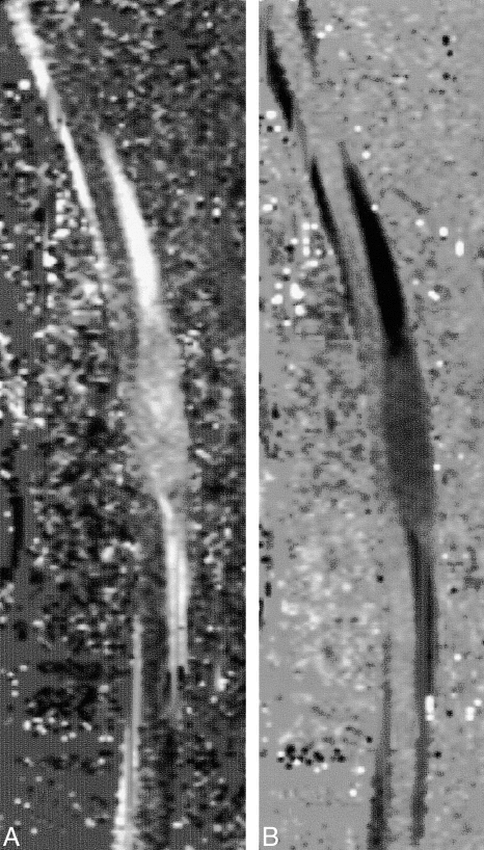 fig 3.