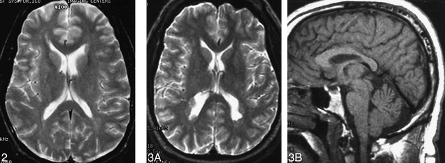 fig 2.
