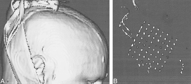 fig 1.