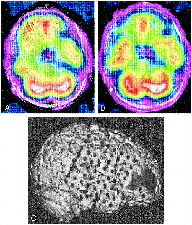 fig 3.