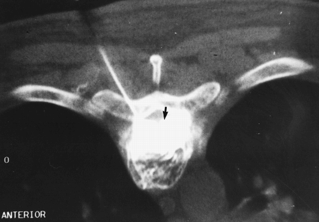 fig 1.