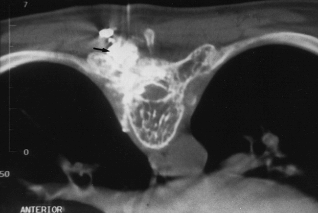 fig 2.